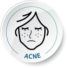 Celluma, acne, face